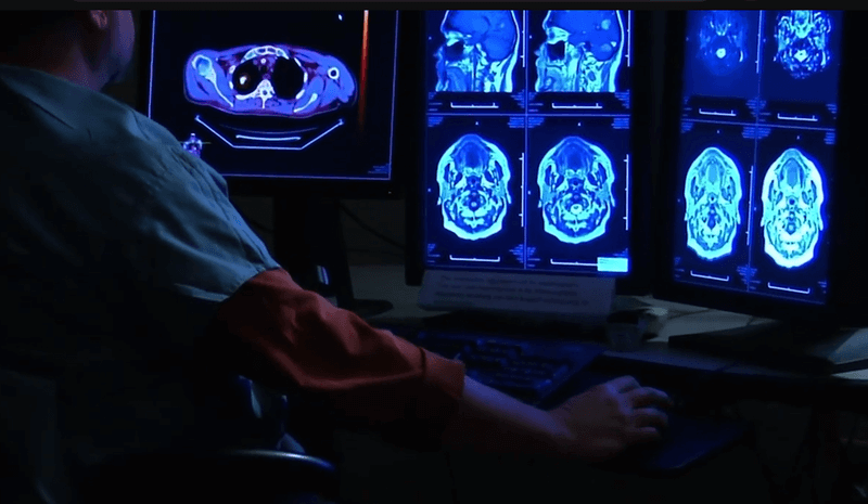 Photo of a radiologist looking at images from an MRI of a person's head
